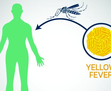 Yellow fever