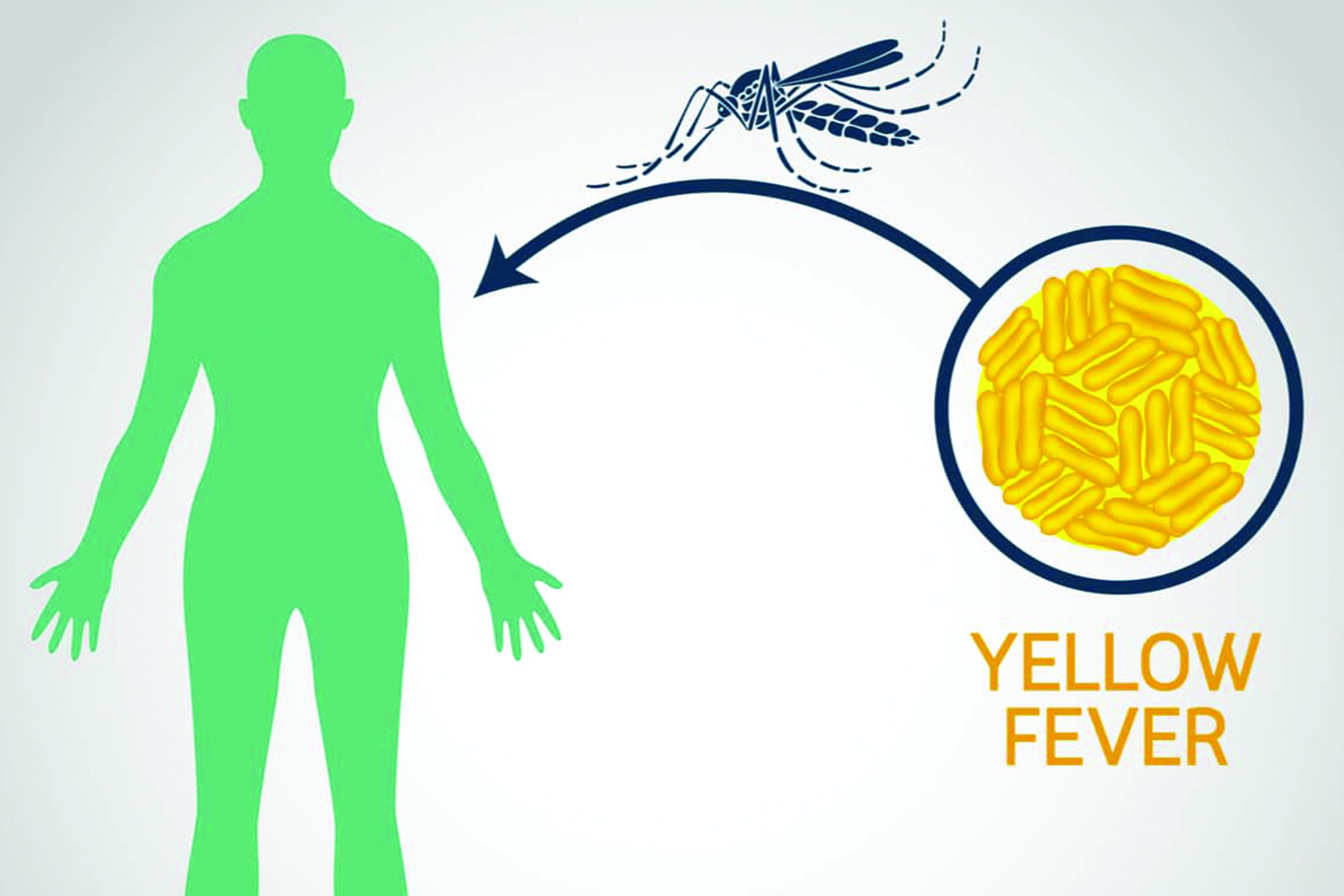 Yellow fever